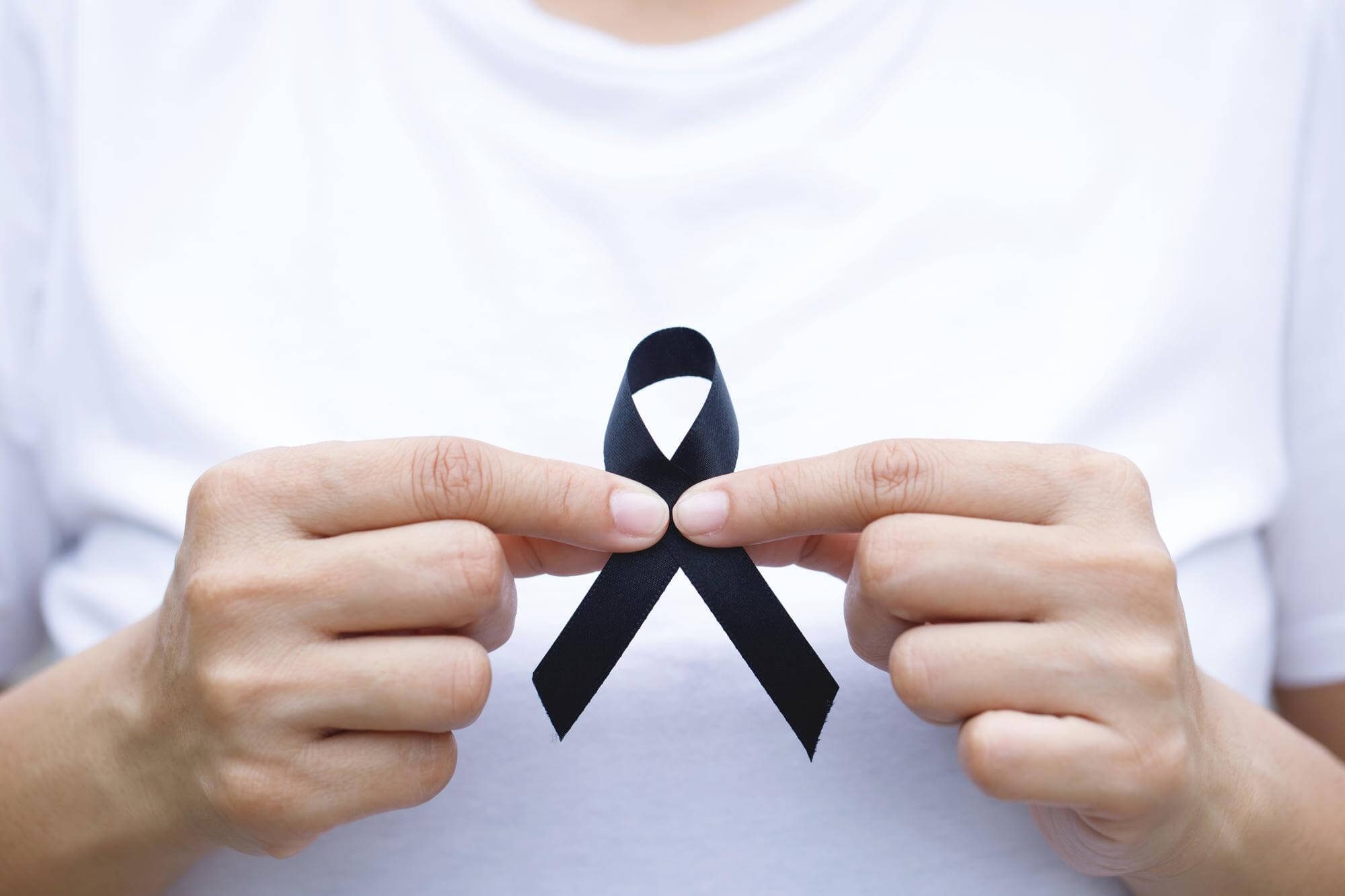 hiv-aids
