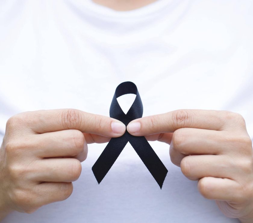 hiv-aids